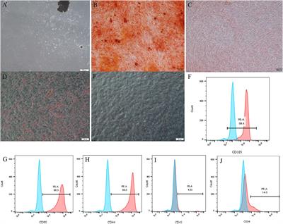 Novel Molecule Nell-1 Promotes the Angiogenic Differentiation of Dental Pulp Stem Cells